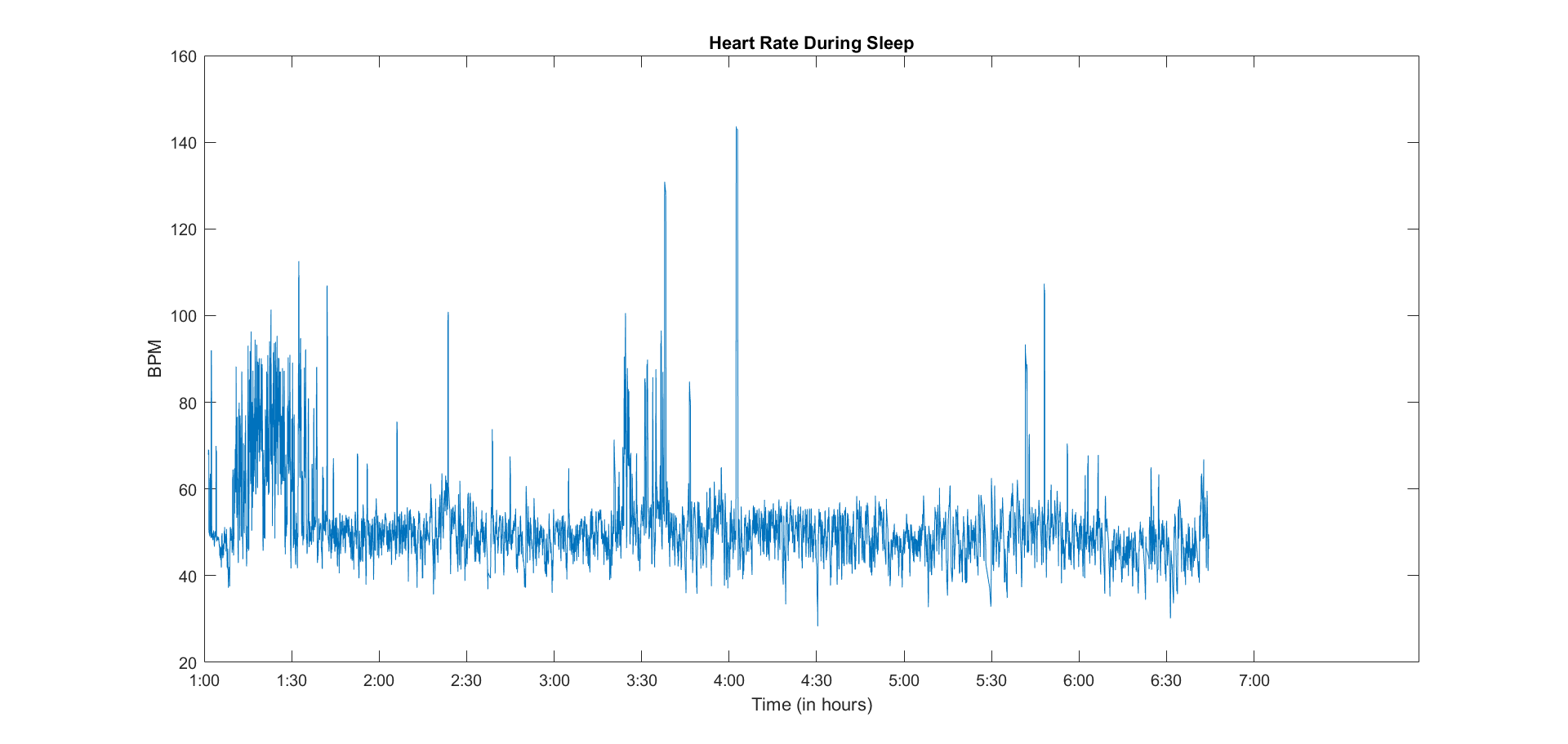 my heartbeat while sleeping